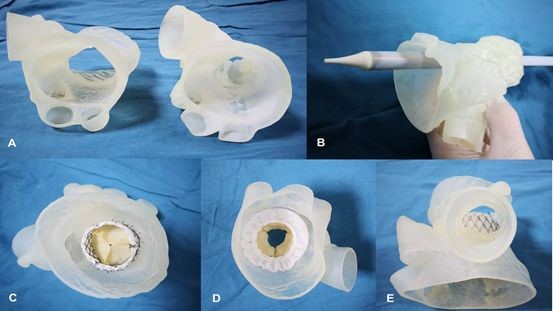 逐漸納入醫(yī)保范圍的3D打印模型，將會對醫(yī)工結(jié)合帶來哪些不同？